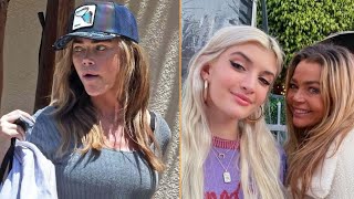Denise Richards Spotted with Bruised Eye: The Truth Behind the Mystery Mark #celebrity