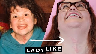 We Reveal The Stories Behind Our Scars • Ladylike
