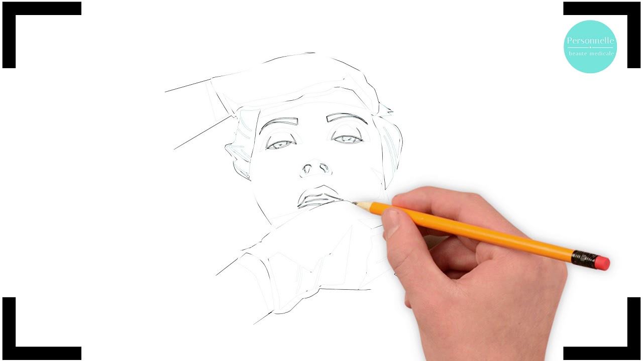 Мануальная пластика №4 - YouTube