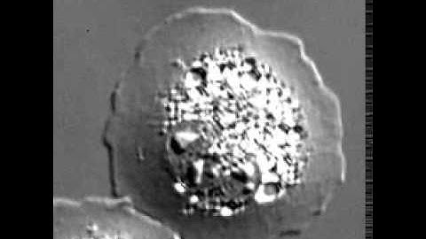 Spreading of a typical fibroblast expressing control shRNA on fibronectin
