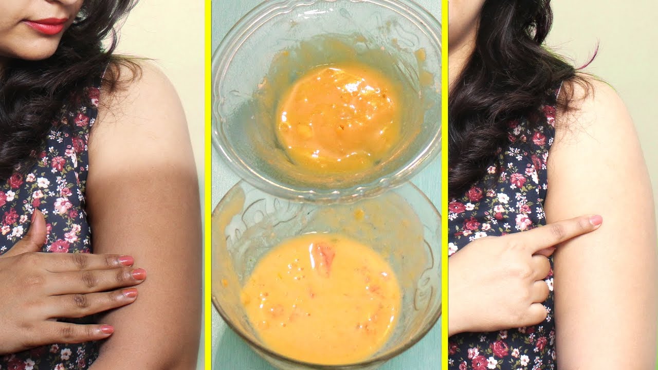 Remove SUN TAN Quickly at Home 100 Effective & Natural Remedy YouTube