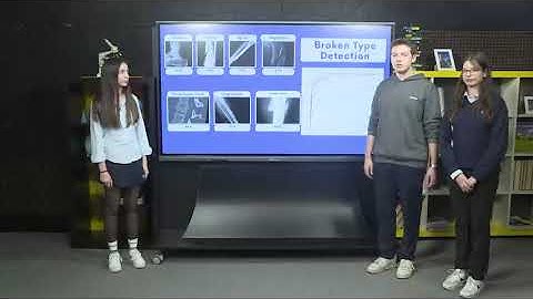 FD: DEEP LEARNING BASED BONE FRACTURE DETECTION SYSTEM FROM X-RAY IMAGES