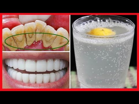 Video: 3 sätt att ta bort tefläckar från tänderna