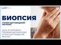 💉 Цель и методика проведения биопсии узлов щитовидной железы. Биопсия узлов щитовидной железы. 12+