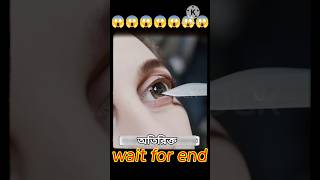 সার্জারির পর আধা মাইল দূরেও দেখতে পারবে! 🤯#trending #facts #viral #shortsfeed #viralvideo #youtube