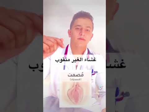 فيديو: كم عدد أنواع البكرات الموجودة؟