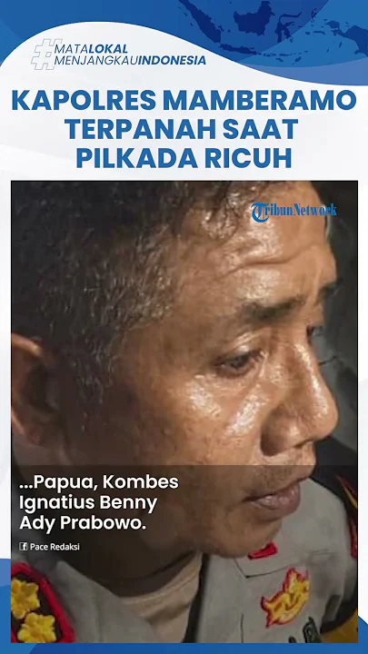 Penampakan Kapolres Mamberamo Tengah Diserang saat Amankan Pilkada, Rahang Pipi Tertancap Panah