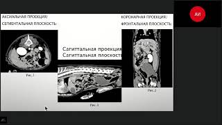 Основы КТ диагностики