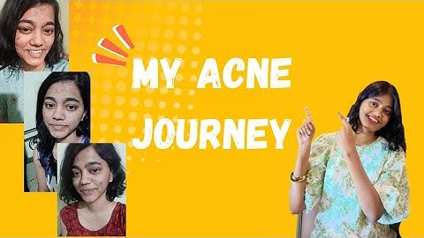 MY ACNE JOURNEY | REAL. RAW & UNFILTERED | How I got rid of my acne 🌿
