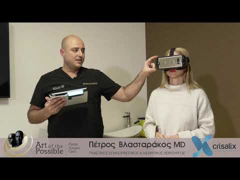 Βίντεο: Η σύζυγος του Stas Mikhailov διέψευσε τις πληροφορίες ότι έκανε πλαστική χειρουργική