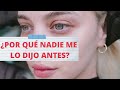 ¡DEJA DE HACER ESTO EN TU SKINCARE! (ACIERTOS Y DESACIERTOS)