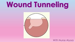 Wound Tunneling What you should know