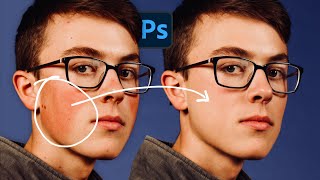 How to Fix Red Patch Areas on Skin Using AI in Photoshop!