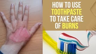HOW TO USE TOOTHPASTE TO TAKE CARE OF BURNS
