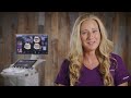 Fetal Measurements Made Easy | SonoBiometry Tips & Tricks