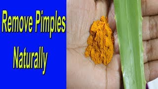 How To Remove Pimples beauty tips in Telugu | Aloe vera Turmeric to Get Rid Of Pimples beauty hacks
