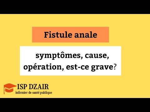 Vidéo: Une fistule périlymphale peut-elle guérir d'elle-même ?