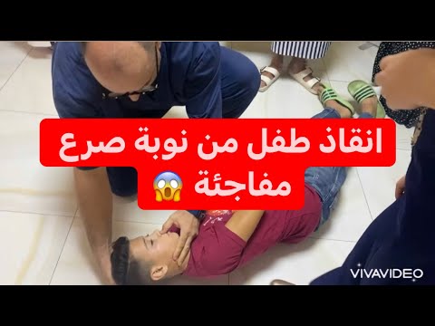 نوبة الصرع المفاجئة شاهد كيف تنقذ طفلك       
