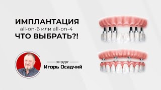 Имплантация Все-на-4 и Все-на-6, что выбрать?