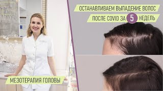 ОСТАНАВЛИВАЕМ ВЫПАДЕНИЕ ВОЛОС ПОСЛЕ COVID