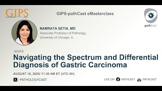#GIPS Navigating the Spectrum and Differential Diagnosis of Gastric Carcinoma