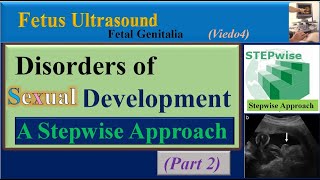 Fetus Ultrasound, Disorders of Sexual Development Part2