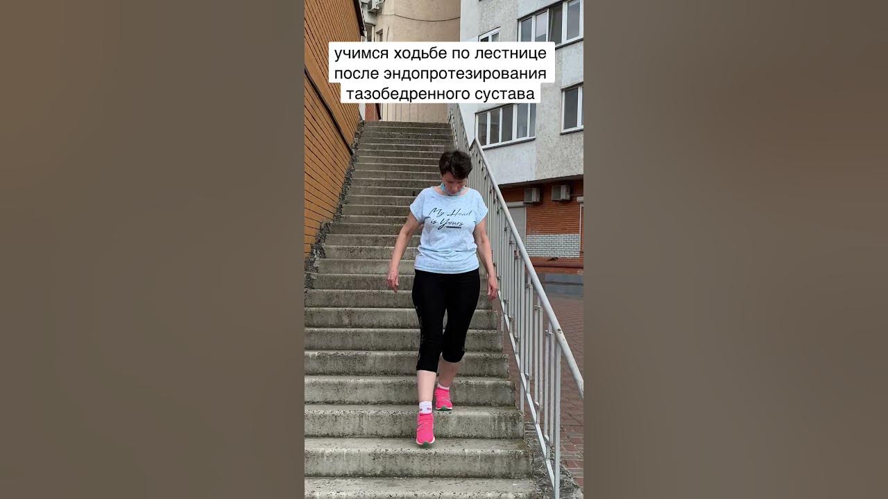 Как спускаться по лестнице после эндопротезирования тазобедренного. Ходьба по лестнице после эндопротезирования тазобедренного сустава. ходьба по лестнице до и после.