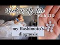 life in lockdown, new job, and new diagnosis! | type 1 diabetes week in my life