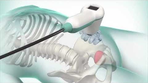 BladderScan BVI 9400