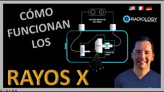 Cómo FUNCIONAN los RAYOS X?  | TUBO DE RAYOS X partes y funciones ☢ |  ¡RADIACIÓN IONIZANTE !