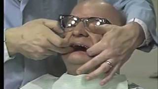 Delivery of Complete Denture  Part 1