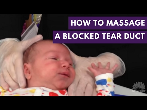 Video: Geblokkeerde Traanbuis Baby: Thuisbehandelingen