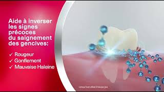Parodontax Aide À Prévenir Et À Combattre Les Saignements Des Gencives