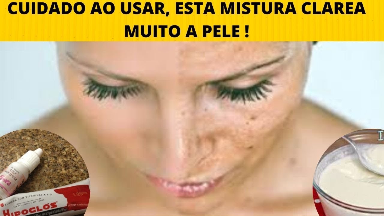 Como Clarear a Pele do Rosto, RECEITA CASEIRA - YouTube
