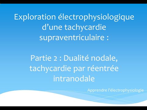 Exploration électrophysiologique d'une TSV. Partie 2 : Dualité nodale et TRIN