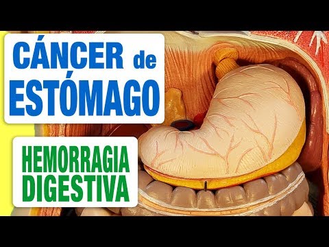 Síntomas del cáncer