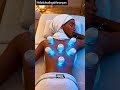 why hijama ( cupping)  is beneficial for you