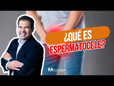 Vídeo: L'espermatocele causa dolor?