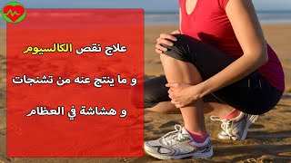 تخلصوا من نقص الكالسيوم و آثاره الجانبية و ارفعوا معدلاته في جسدكم