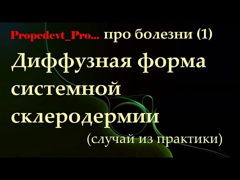 Системная склеродермия (ССД). Диффузная форма. Случай из врачебной практики.