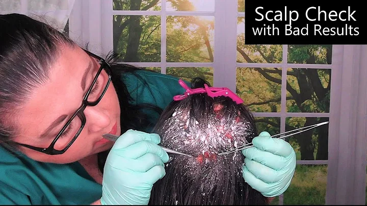 ASMR Scalp Check with Bad Results (Dandruff Removal, Scalp Treatment, Whispering) Medical Roleplay