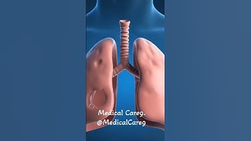 Asthma Explained: Causes, Symptoms & Life-Saving Treatment #asthma #asthmarelief #asthmaattack