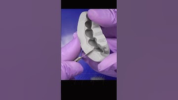 Immediate temporary dental crown