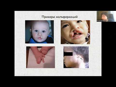 Видео: Туморирующие клетки: критический обзор подходов к изоляции и новые вызовы в стратегиях таргетирования