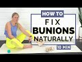 HOW TO SHRINK BUNIONS NATURALLY | Bunion Exercises
