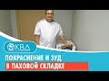 👉 Покраснение и зуд в паховой складке. Клинический случай №979