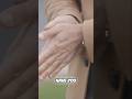 ICY HANDS & FEET: Is Your Body Screaming for Help? #shorts