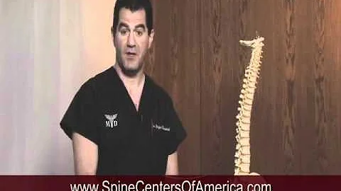 What is a Pinched Nerve - Spine Centers of America...