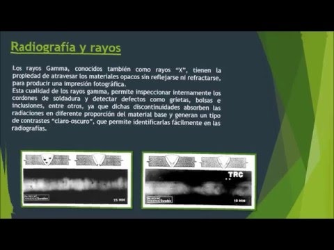 Vídeo: Síndrome De Radiación Aguda En Un Trabajador De Pruebas No Destructivas: Reporte De Un Caso