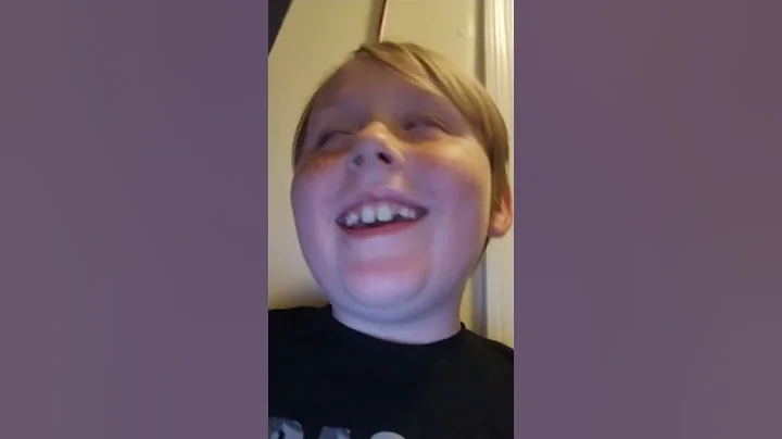 Benjamin face reveal